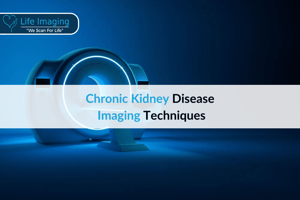 Chronic kidney disease