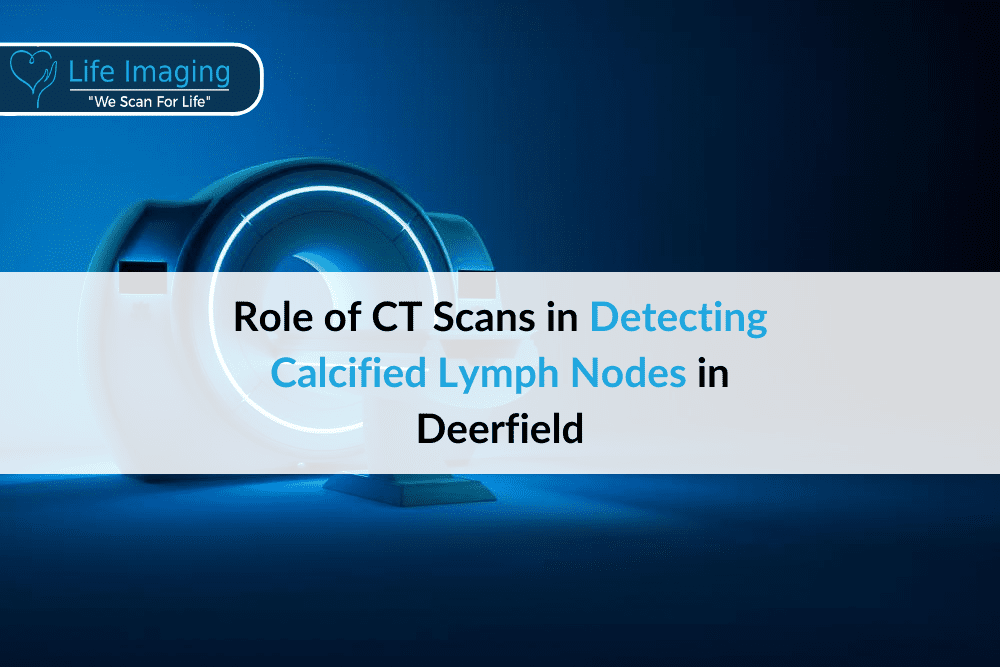 Role of CT Scans in Detecting Calcified Lymph Nodes in Deerfield